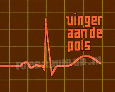 Vinger aan de Pols